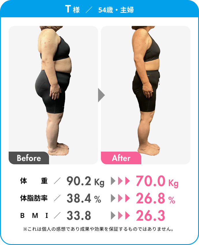 T様（54歳・主婦）のビフォーアフター